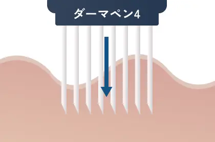 STEP01のイメージ