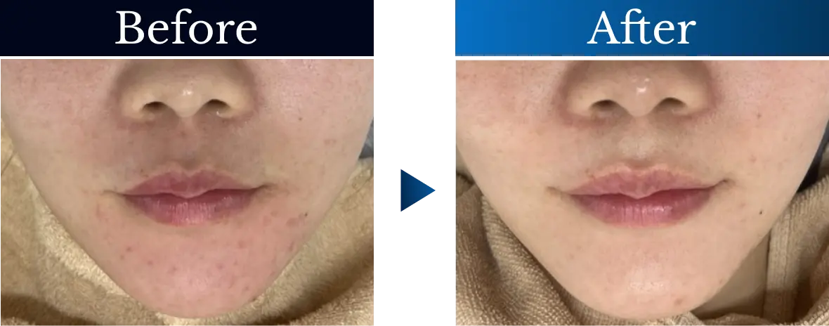 ビフォーアフター画像