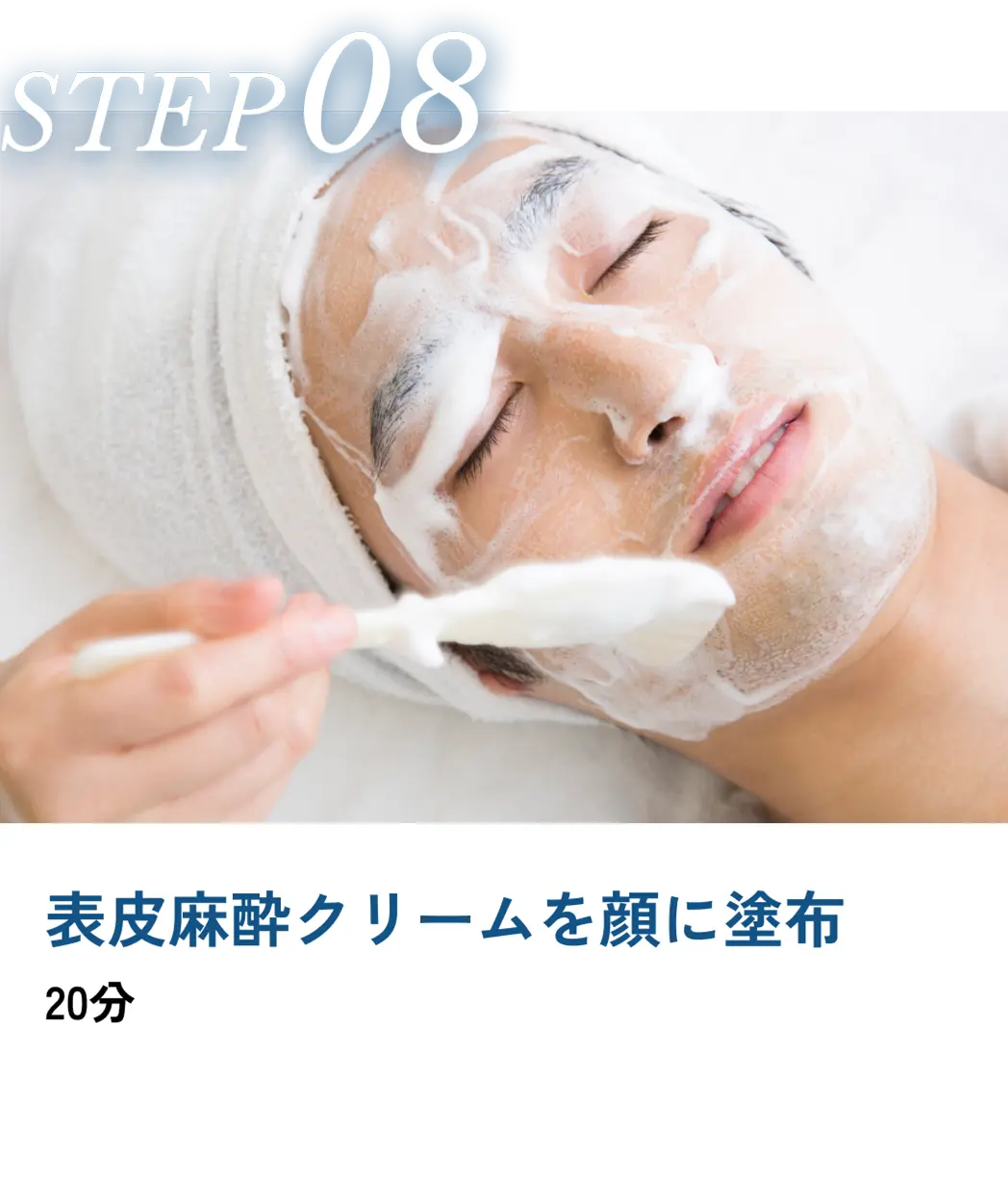 表皮麻酔クリームを顔に塗布