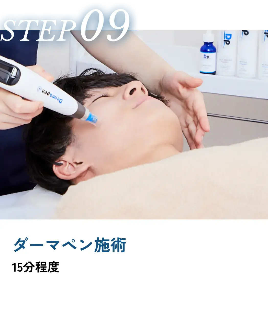 ダーマペン施術